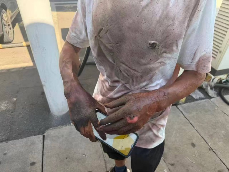 Post alleges charging-port short circuit caused burn