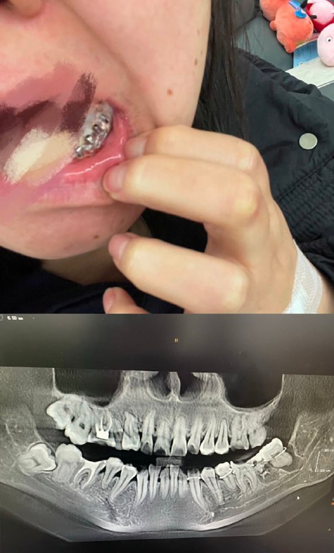 Post alleges woman died after tooth extraction