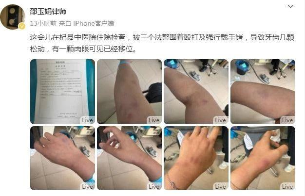 Disputes over Treatment of Lawyers in China