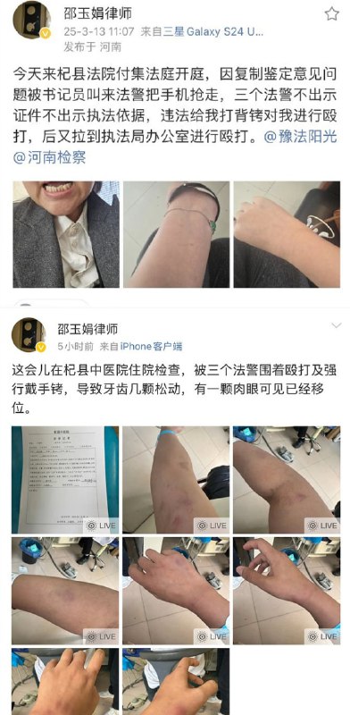 Disputes over Treatment of Lawyers in China
