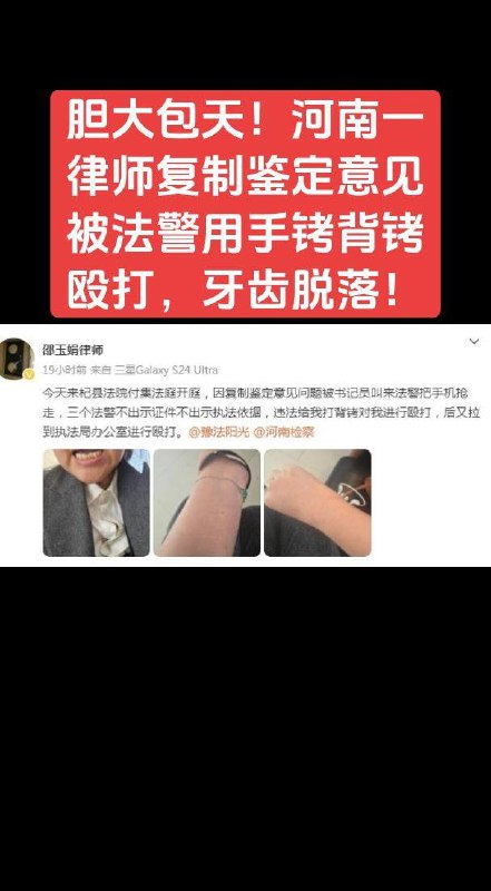 Disputes over Treatment of Lawyers in China